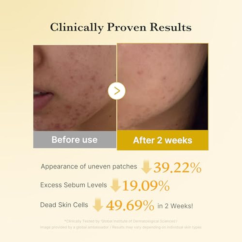 Kojic Acid Prep and Seal Duo for Troubled Skin: Kojic Acid Turmeric Overnight Wrapping Peel off Mask 2.0 and Kojic Acid Turmeric Clarifying Toner Pad