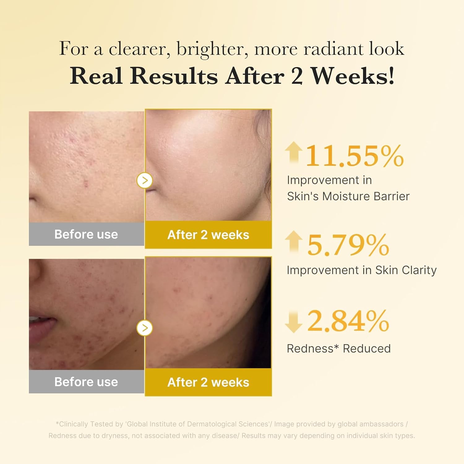 Kojic Acid Overnight Care & Nourish Duo for Troubled Skin: Kojic Acid Turmeric Overnight Wrapping Peel off Mask 2.0 and Kojic Acid Turmeric Clarifying & Balancing Capsule Serum